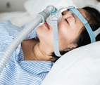 Sleep Apnea